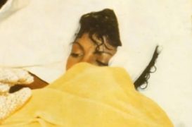 Jan. 27, 1984: Michael Jackson Burned in Pepsi Spot